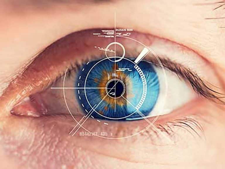 Glaucome et cataracte etc.-aura-santé.com